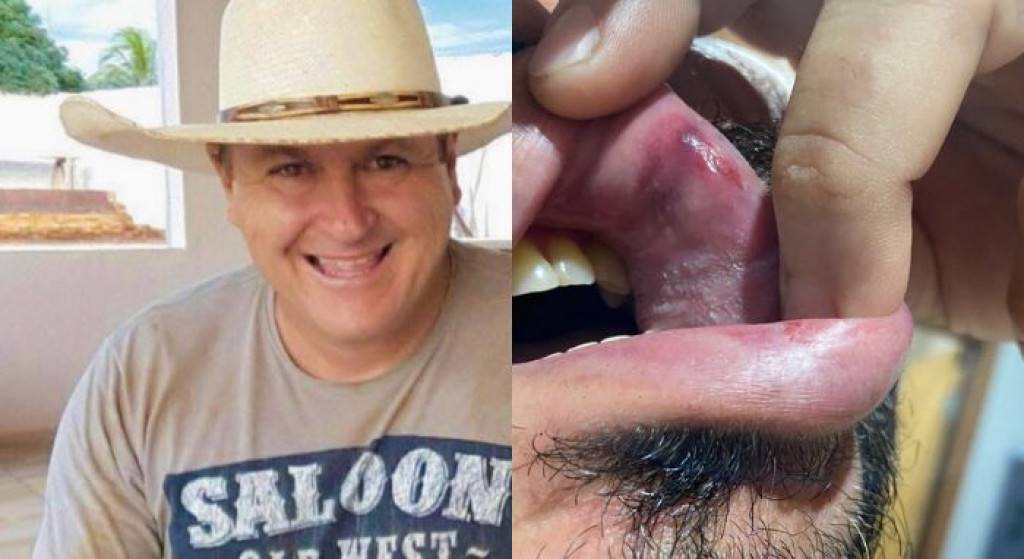 Homem tenta cobrar vereador de MT por dívida de gado e leva soco na cara