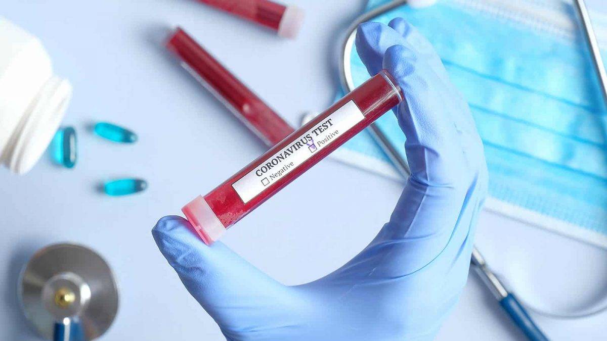 Quinta-feira (26): SES monitora 11 casos confirmados e 385 suspeitos de coronavírus 