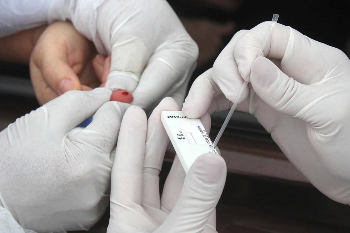 Prefeituras fazem testes sem contraprova e prejudicam dados da covid-19