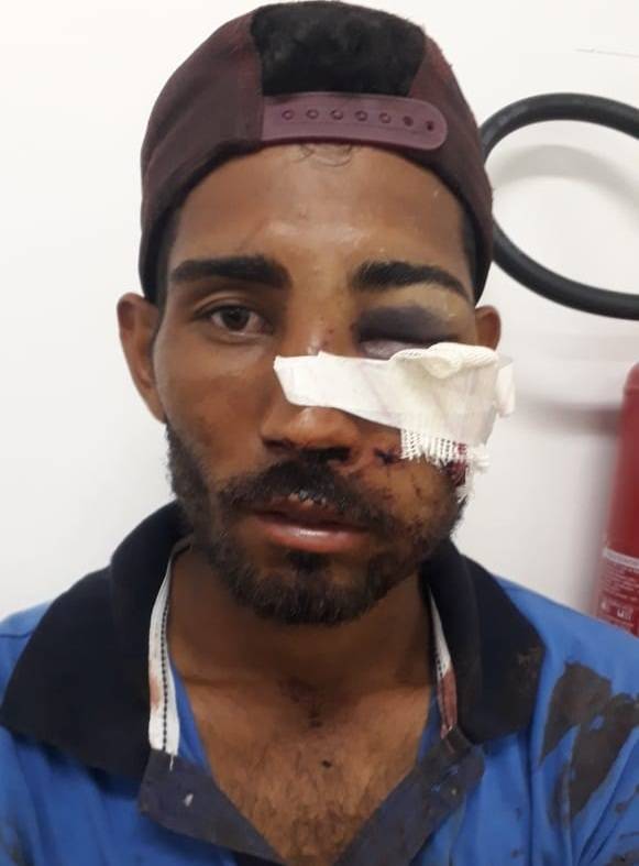 Comando da PM abre Procedimento Administrativo, após policiais serem suspeitos de agredir trabalhador rural 