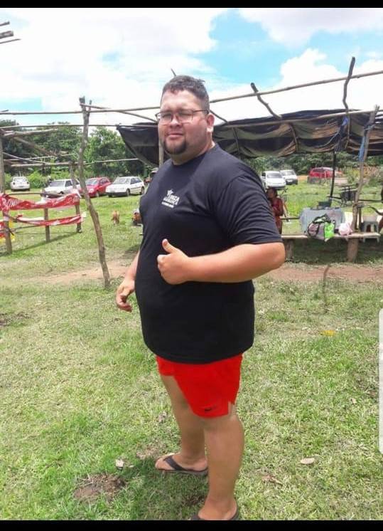 Jovem de 26 morre após sequelas da Covid-19