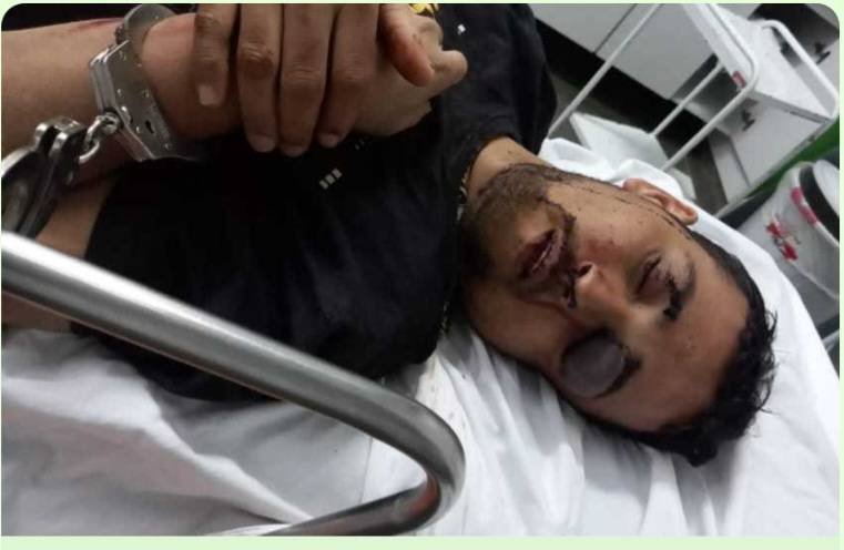 Vereador envolvido em furto está em coma e em estado gravíssimo