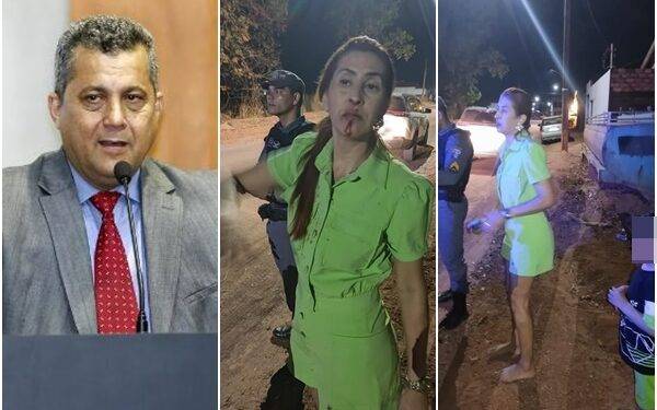 Ex-deputado Baiano Filho é detido suspeito de agredir a esposa em MT; veja fotos 