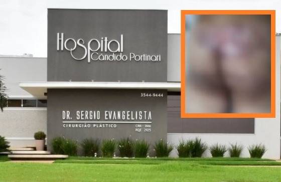 Homem vai fazer cirurgia no nariz e sai com bunda queimada em Sorriso;<VIDEO>